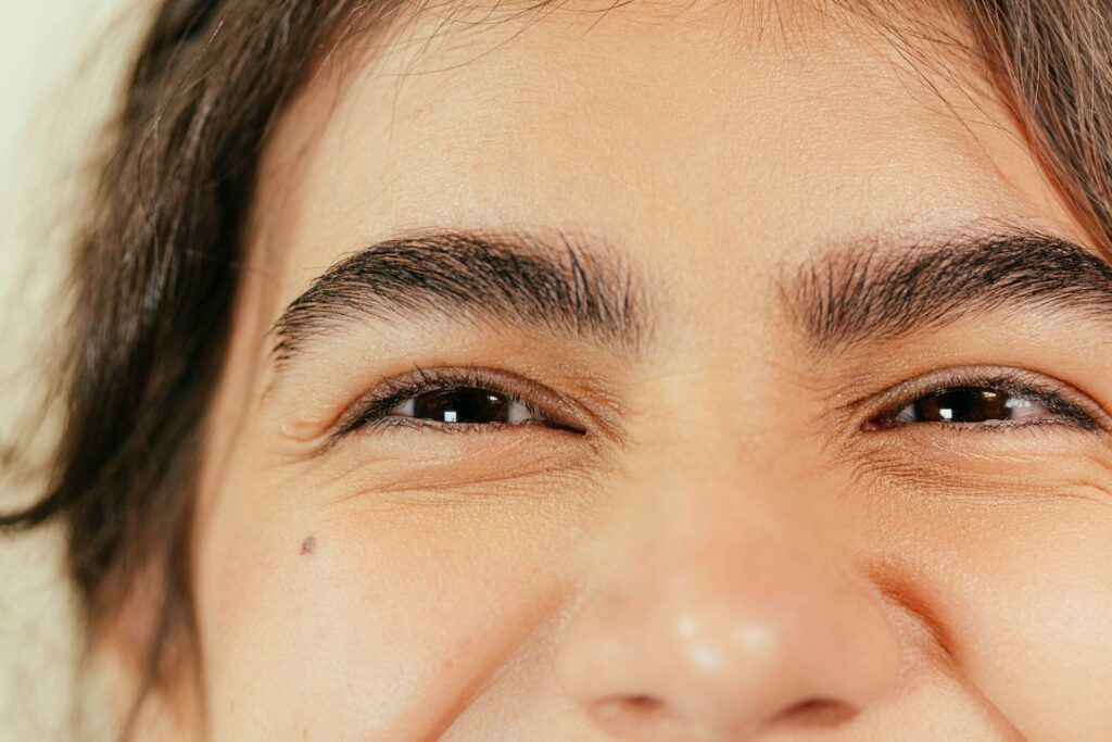 les-ridules-sous-les-yeux